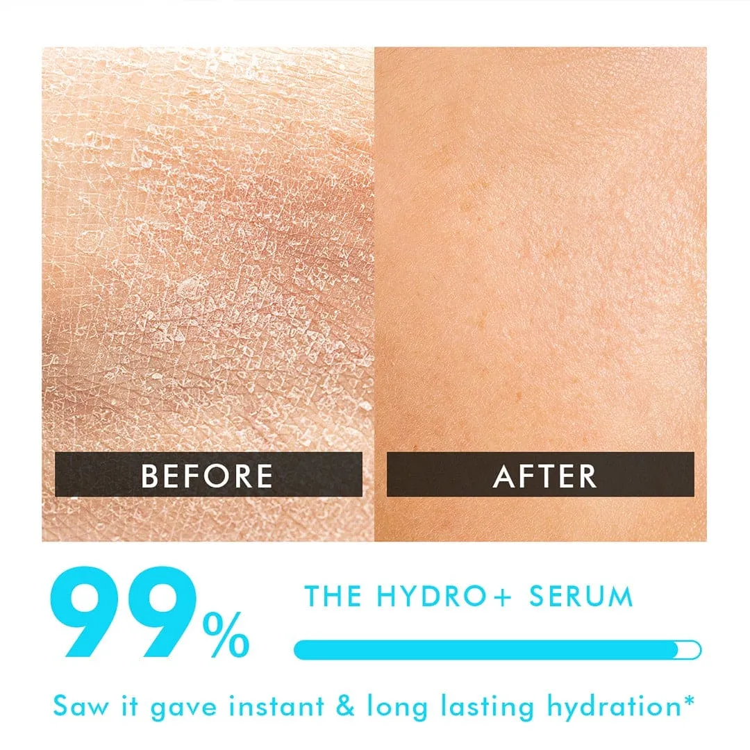 1% Multi-Molecular Hyaluronic Acid Serum | Hydrating & Plumping Serum | Ceramide Complex